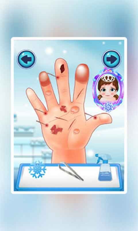 冰雪宝贝手部治疗